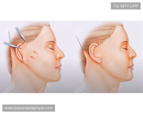 中国开运微整窦靖儿的美容案例分析，帮助用户实现面部微调与运势提升